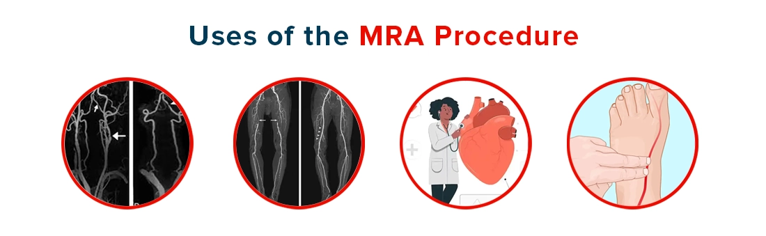 Uses of the MRA Procedure